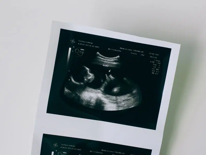 Fertility CICOR Marketing Who we help - Marketing Financial target