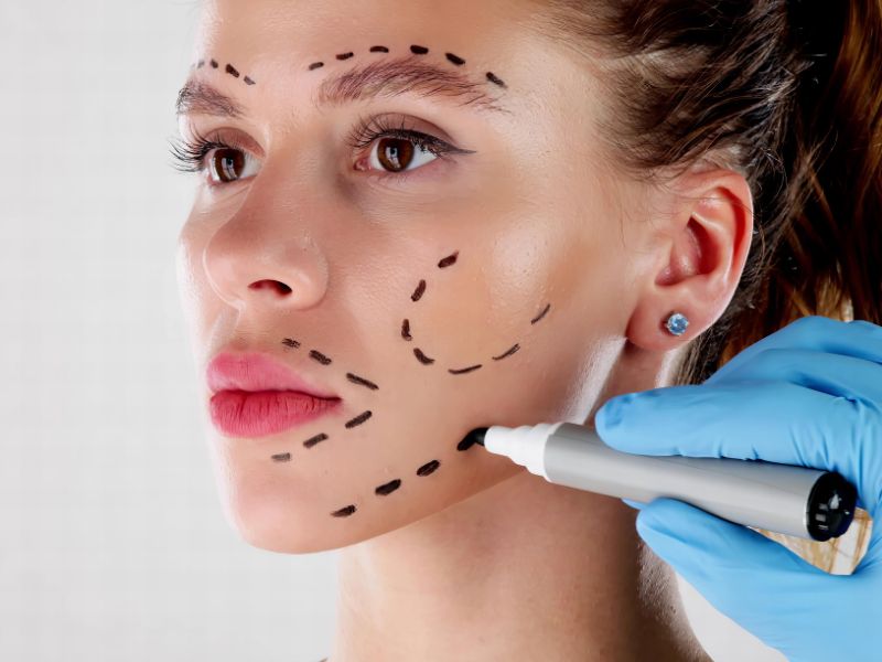 Plastic Surgery Marketing Services by CICOR Marketing! Plastic Surgery Marketing Services by CICOR Marketing